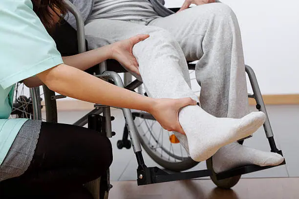 Physical therapy sales for broken leg