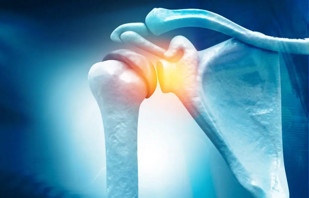 Rotator shop cuff recovery