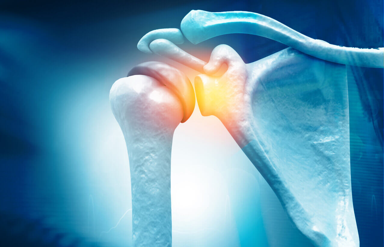 Minimally Invasive Arthroscopic Surgery for Rotator Cuff Tears
