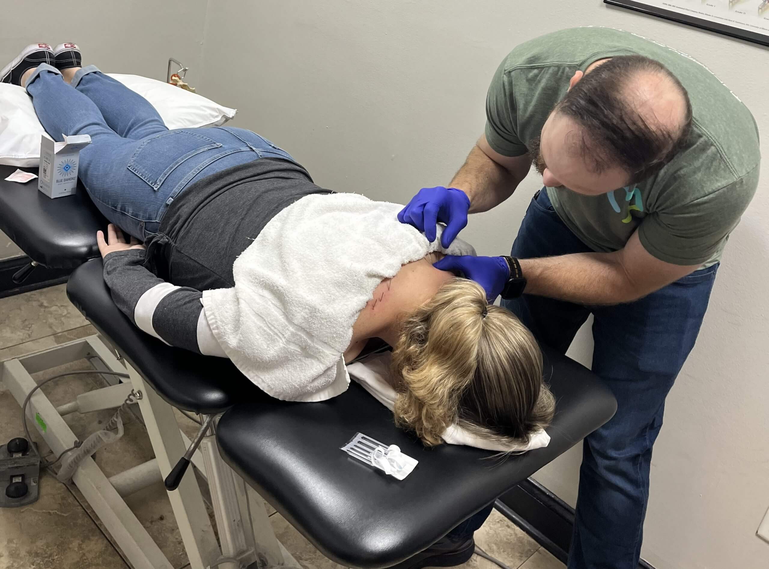 physical therapist doing dry needling